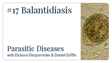 Balantidiasis