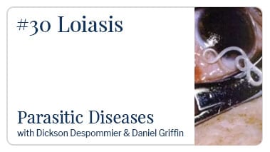Loiasis