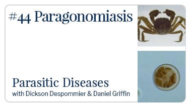 Paragonomiasis