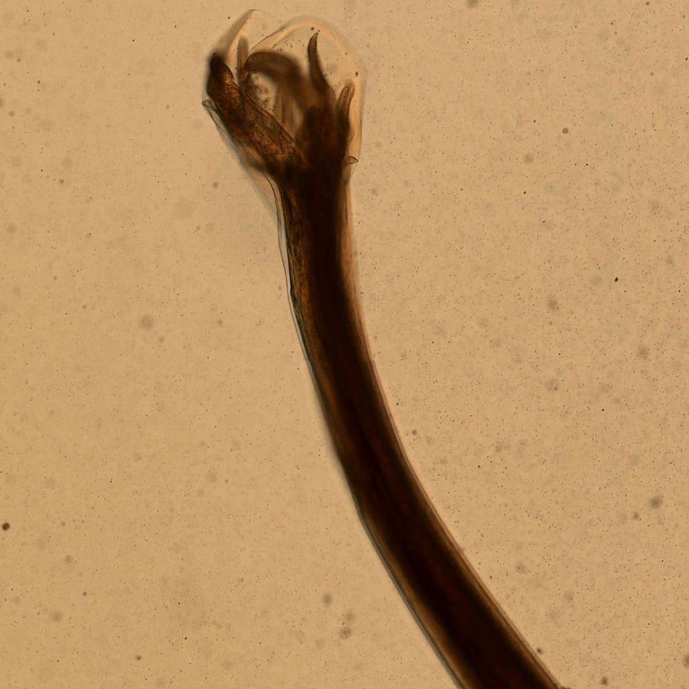 Necator americanus