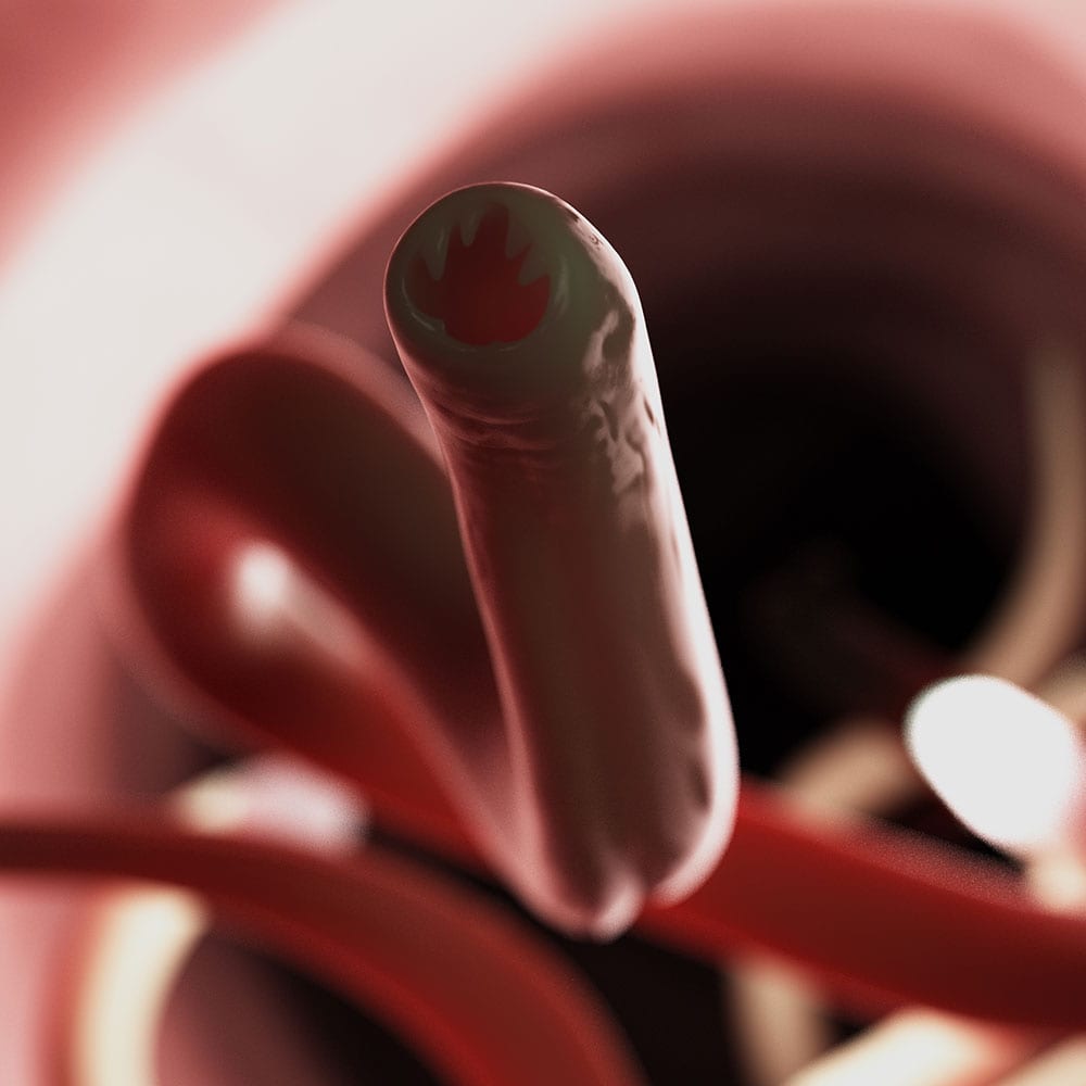 Hookworm