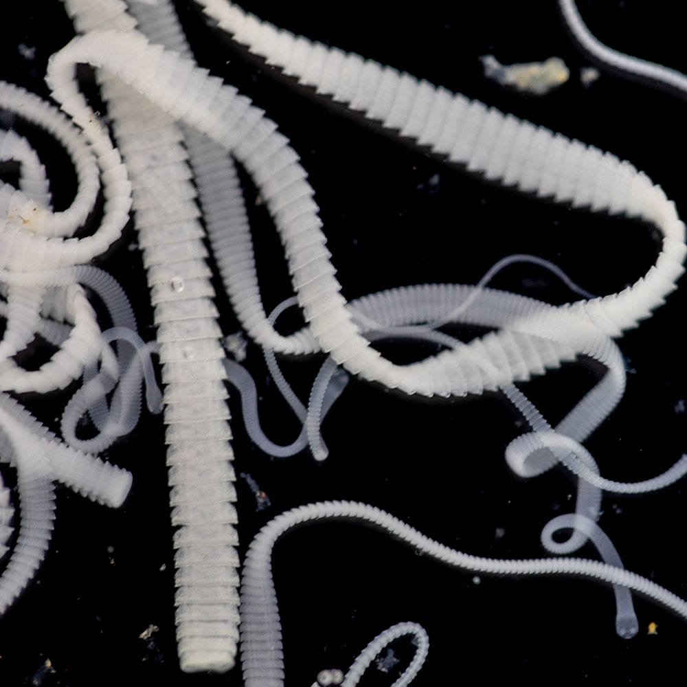 Tapeworms