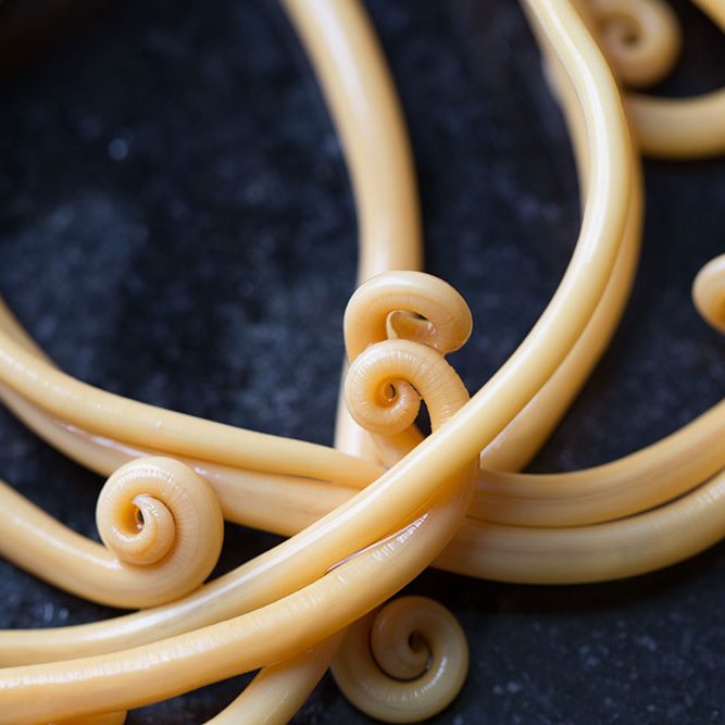 Ascariasis is a disease caused by the parasitic roundworm Ascaris lumbricoides